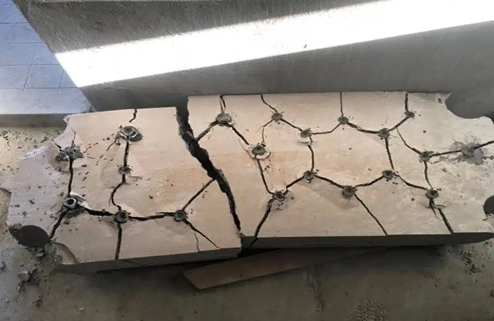 معرفی بهترین نوع کتراک